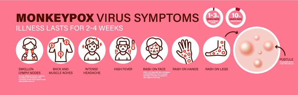 MonkeyPox Virus Symptoms MonkeyPox Virus Symptoms